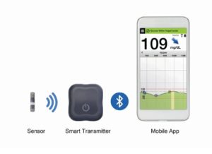 Eversense System